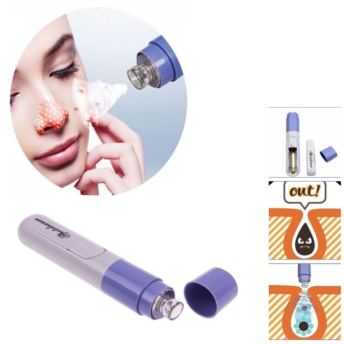Electric Facial Pore Cleanser Face Blackhead Remover Skin Cleaner Tool 4756